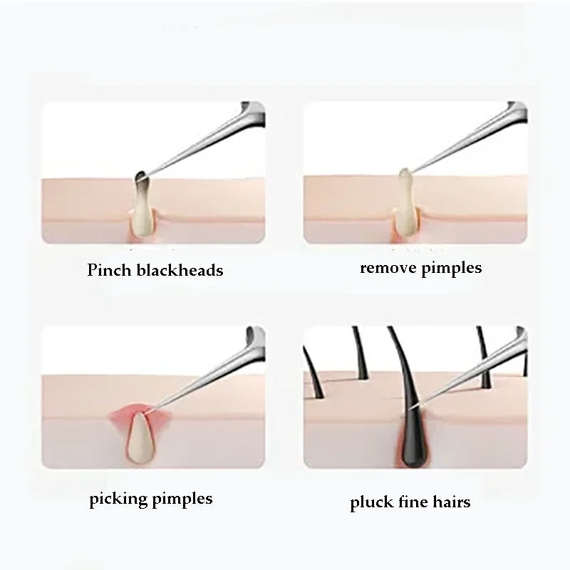 Kovisy Stainless Steel Precision Skincare Tool Kit
