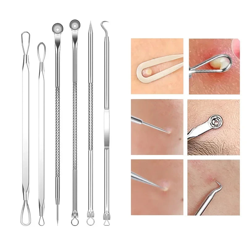 Kovisy Stainless Steel Precision Skincare Tool Kit