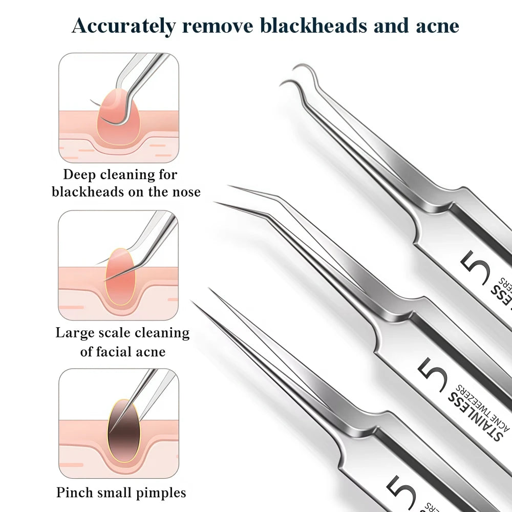 Kovisy Stainless Steel Precision Skincare Tool Kit